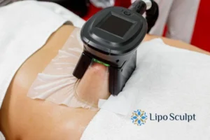 Cryolipolysis Helping You Getting that Perfect Summer Body 3 Cryolipolysis Sherborne can give you the best summer body - contact us today!