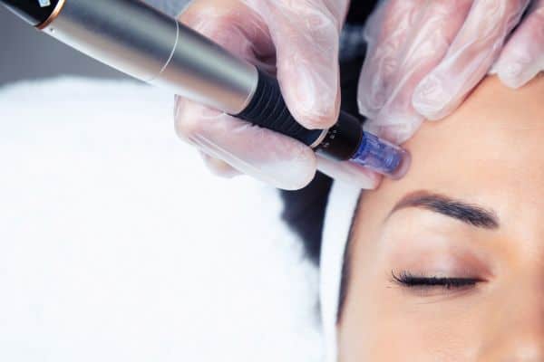 Explaining Total Skin Tightening Treatment and What to Expect 2 What Skin Concerns Can Total Skin Tightening Treatment Help With Sherborne?